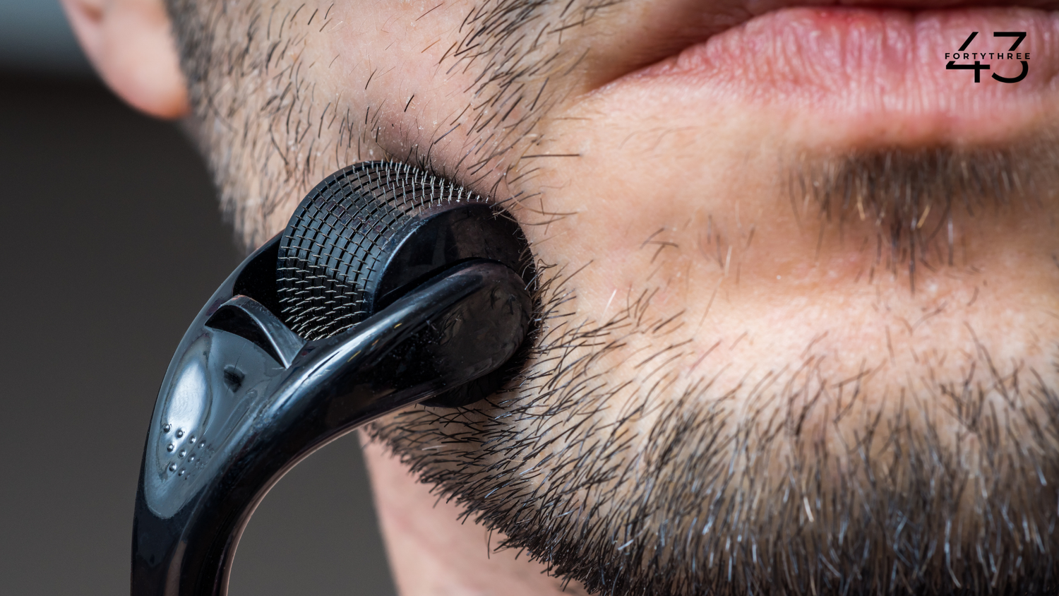The Benefits Of A Derma Roller